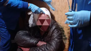 В рязанском поселке из-за падения с лестницы у мужчины открылось кровотечение