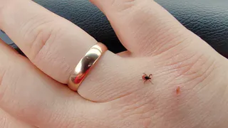 Клещи атакуют: в Рязанской области за неделю пострадали 97 человек — куда бежать и сколько стоит проверка