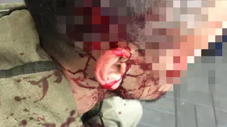 Директор УК, ударивший владельца квартиры молотком, арестован