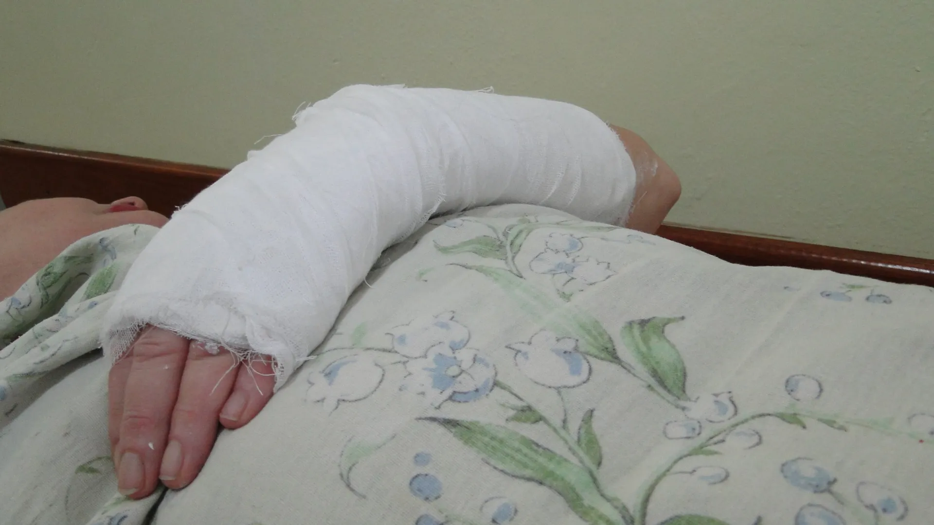 Из-за скользких тротуаров многие рязанцы оказались на больничных койках